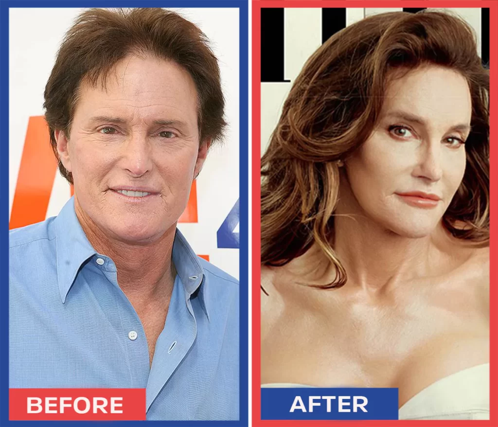 Caitlyn Marie Jenner(William Bruce Jenner)